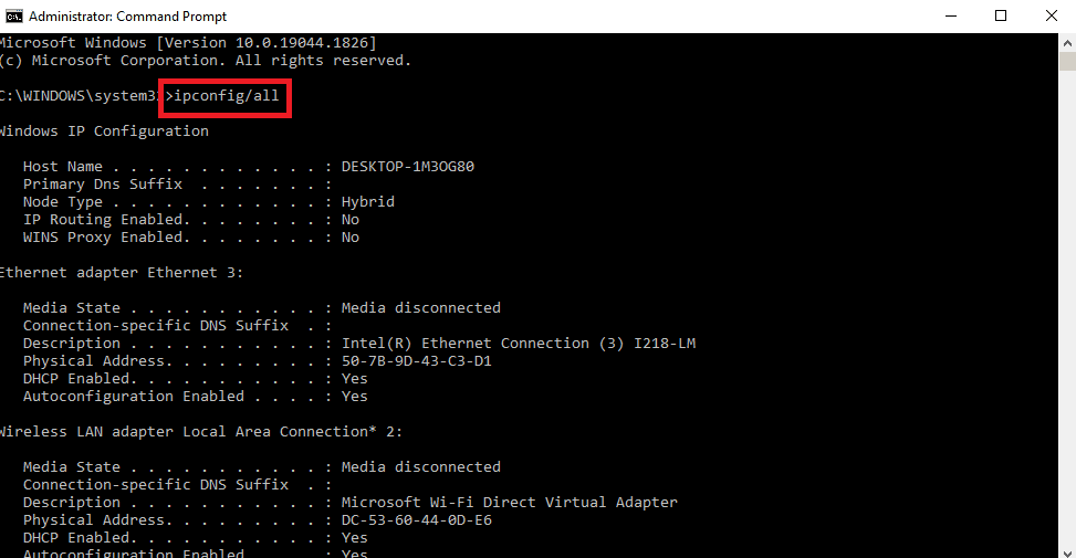 view the details of the IP address of the Internet Connection. Fix Failed to connect to PlayStation network